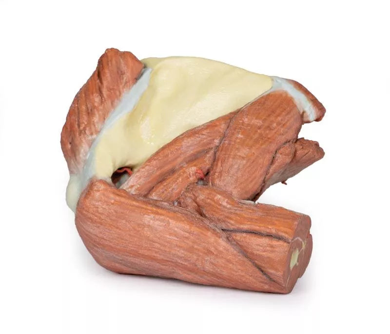 Erler-Zimmer Schulter (links) – Oberflächliche Muskeln mit Arteria axillaris/brachialis