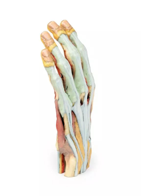 Erler-Zimmer Hand