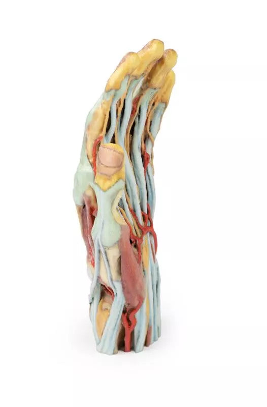 Erler-Zimmer Hand