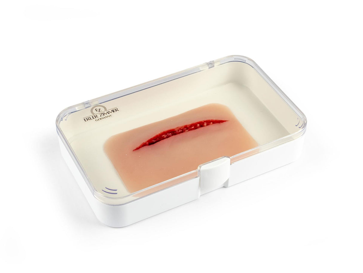 Erler-Zimmer Wundmoulage Schnittwunde