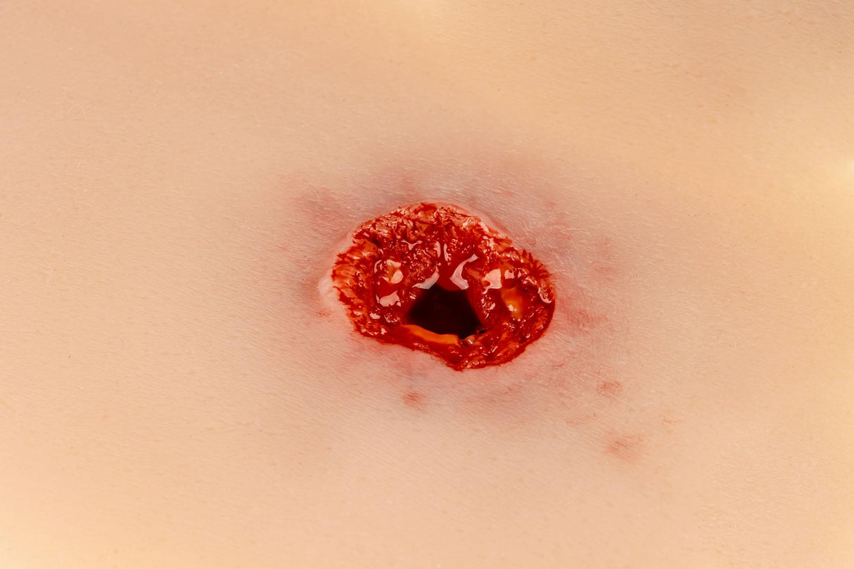 Erler-Zimmer Schusswunde Arm mit Blutungsfunktion
