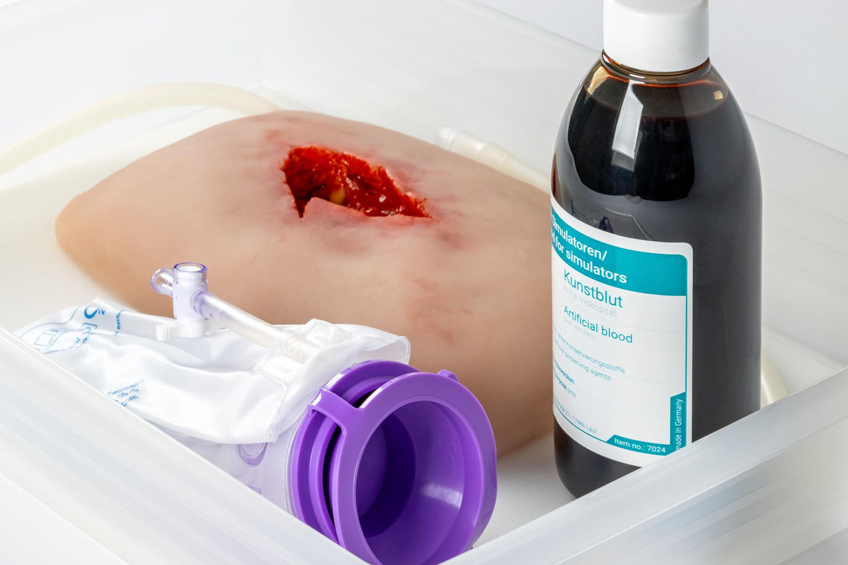 Erler-Zimmer Wundmoulage wound packing