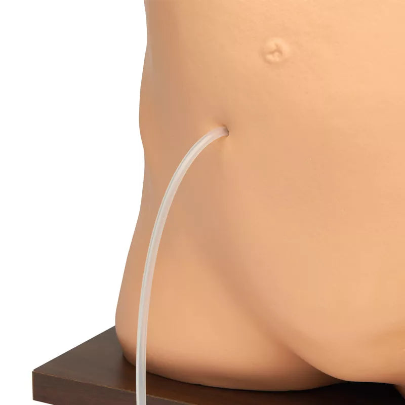 Erler-Zimmer Peritonealdialyse Simulator Modell
