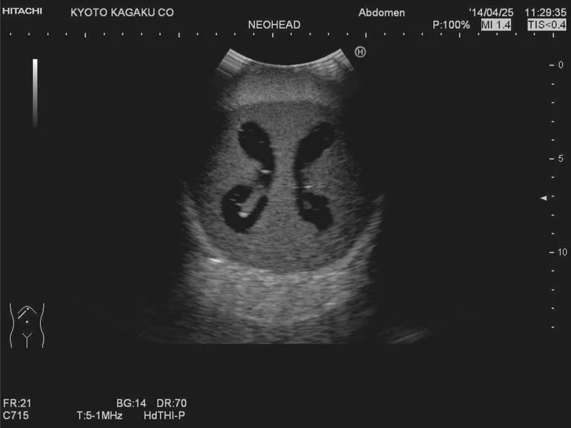 Erler-Zimmer Neonatales Ultraschall-Übungsphantom Kopf mit Hydrocephalus