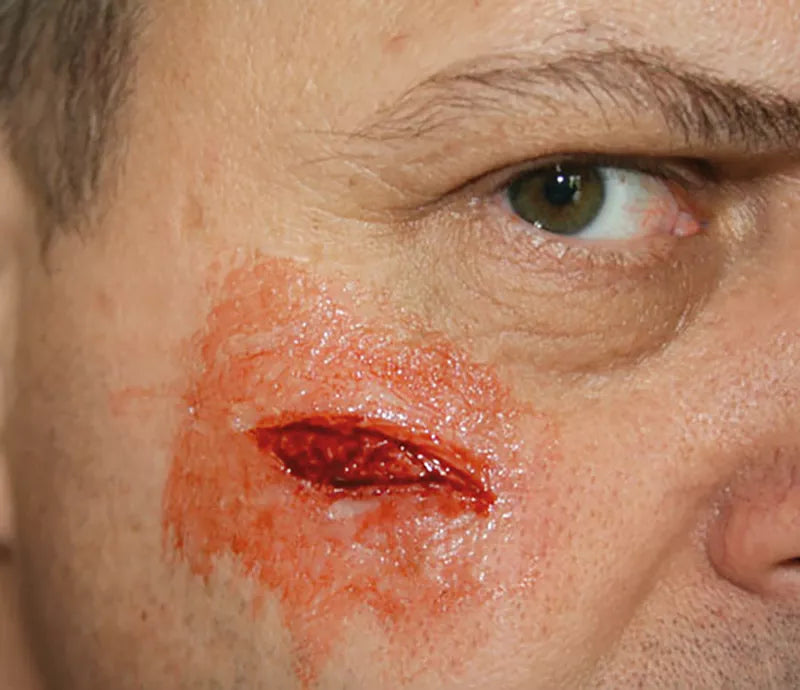 Erler-Zimmer EZ Wounds Wundensimulationsset „Professional“