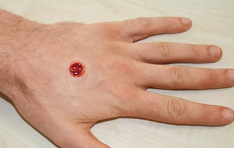 Erler-Zimmer EZ Wounds Wundensimulationsset „Professional“