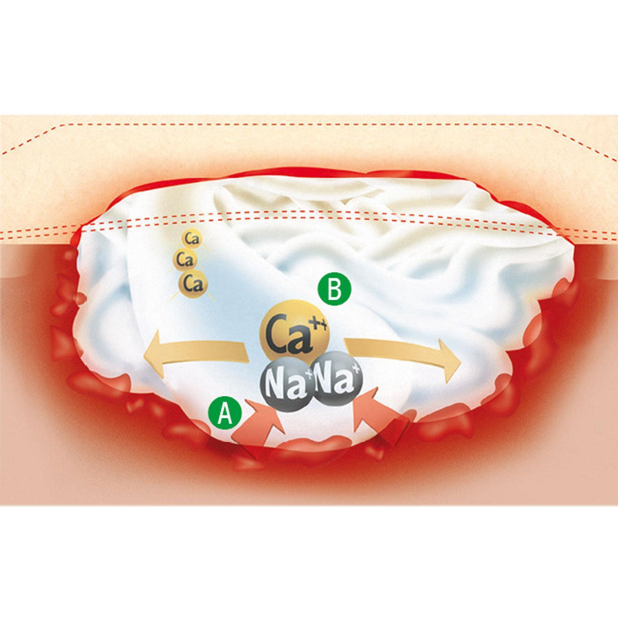 Lohmann & Rauscher Suprasorb A Ca-Alginattamponade 2 x 45 cm 5 Stück
