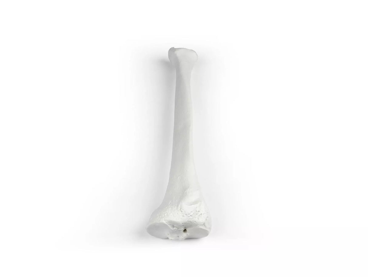Erler-Zimmer Schienbein Modell Tibia