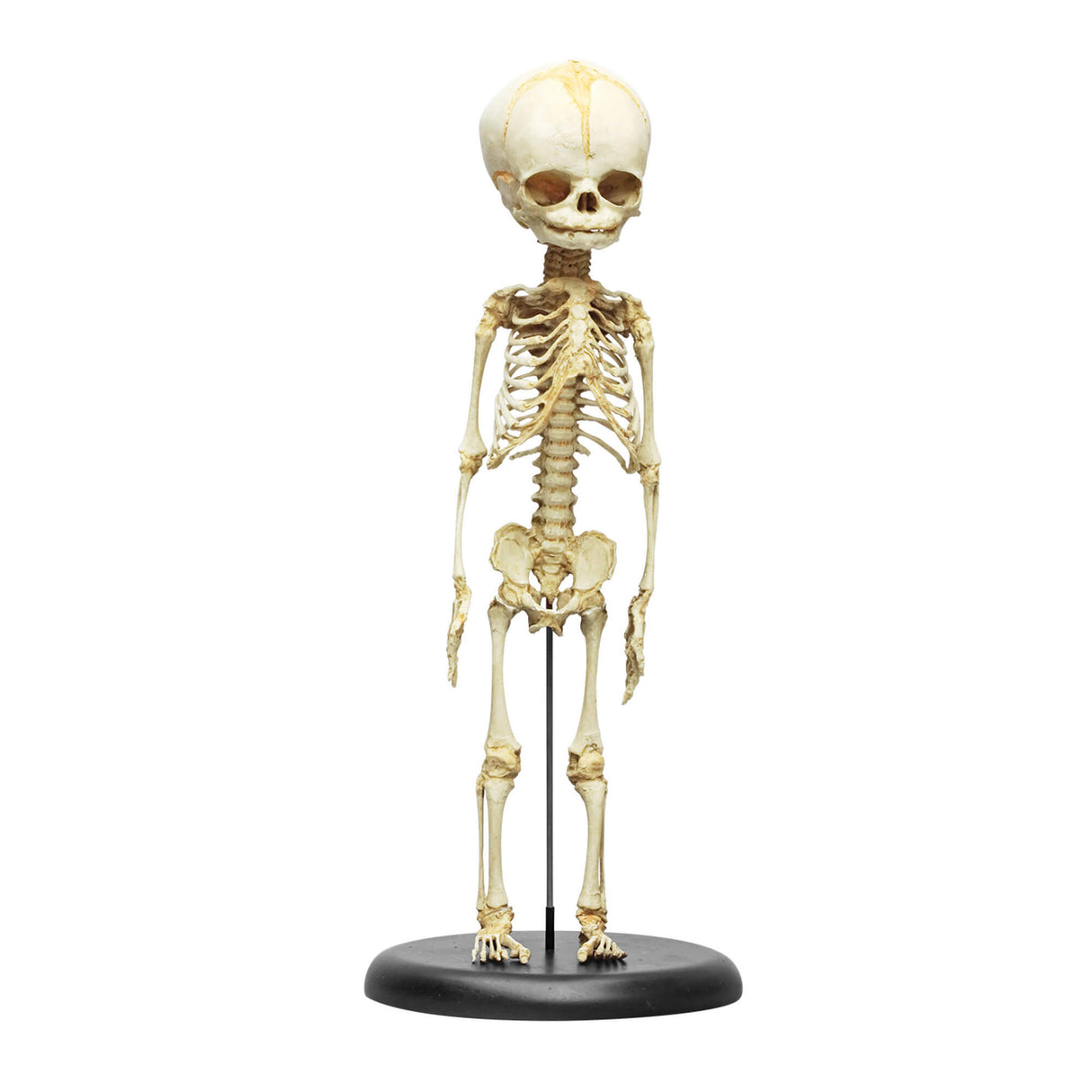 Erler-Zimmer Fetus Skelett Modell 30. Woche