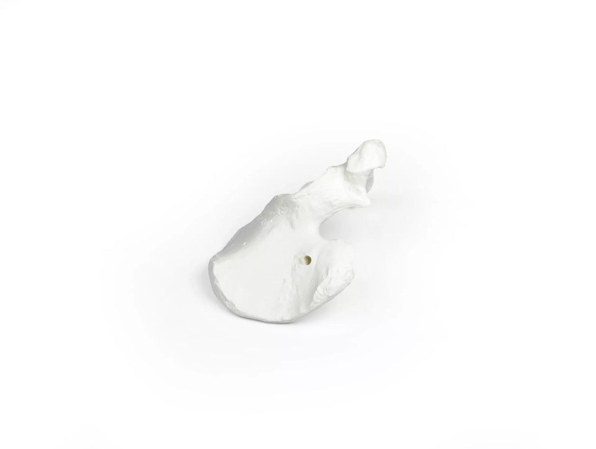 Erler-Zimmer Beckenhälfte Modell