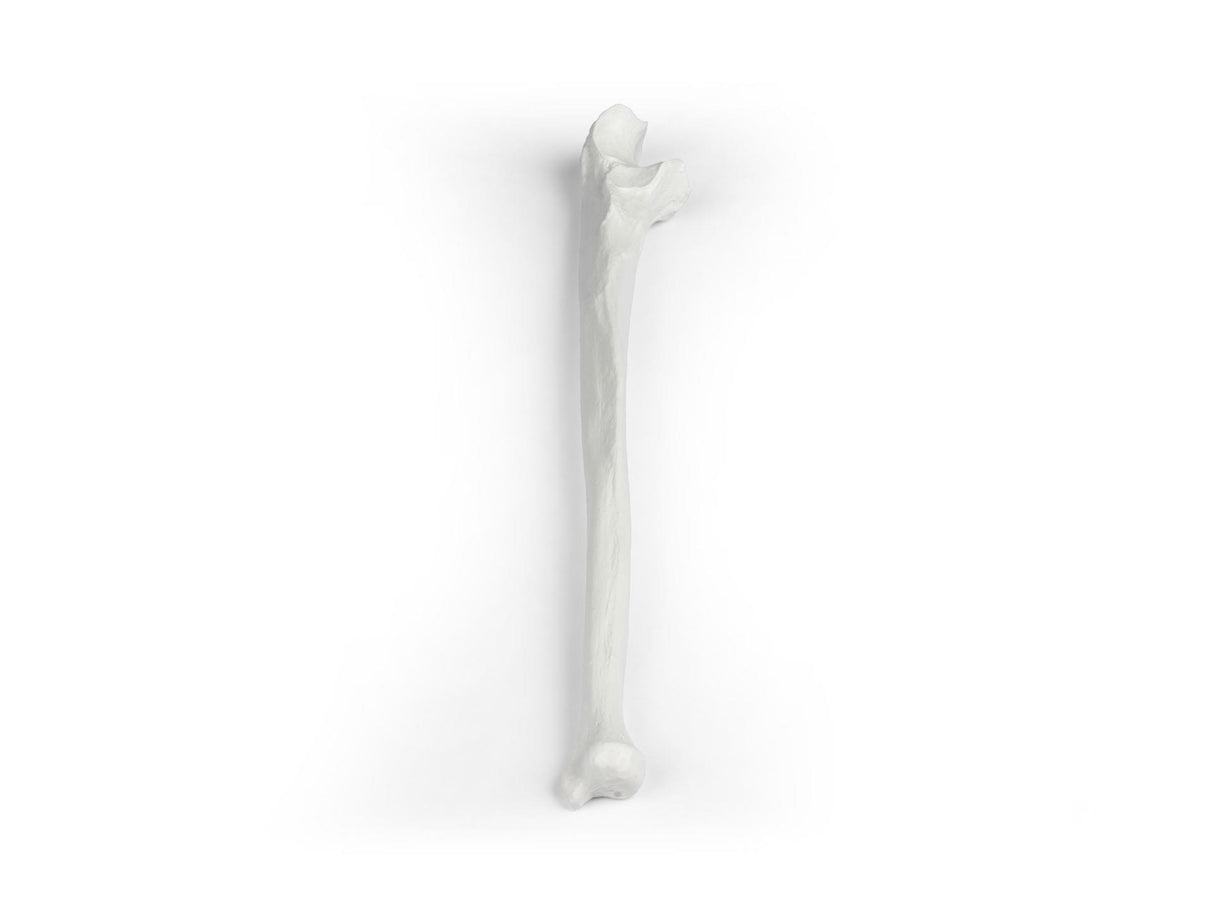 Erler-Zimmer Elle Modell Ulna
