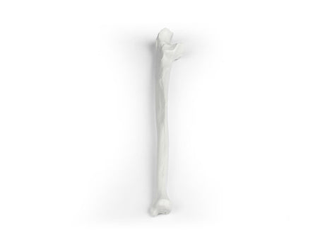 Erler-Zimmer Elle Modell Ulna