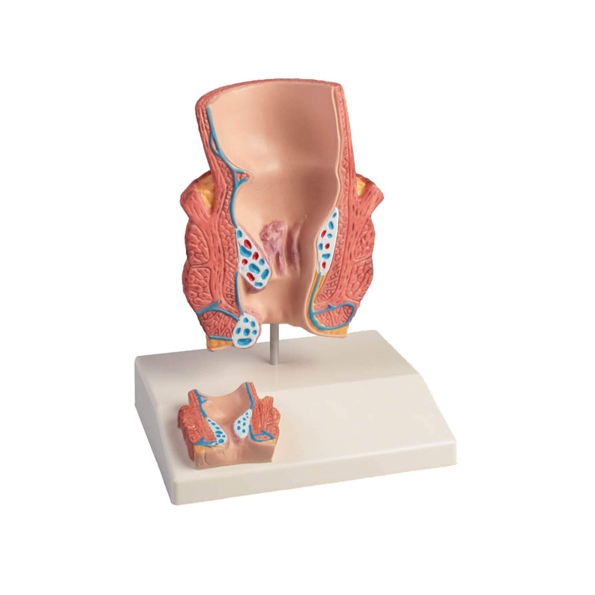 Erler-Zimmer Hämorrhoidenmodell 2 fache Größe