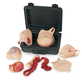 Erler-Zimmer Neonatales Wundset Modell