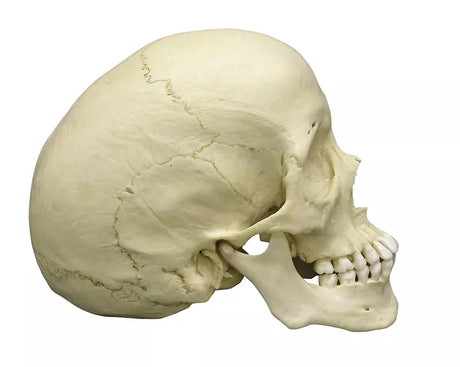 Erler-Zimmer Skaphozephaler Schädel Modell