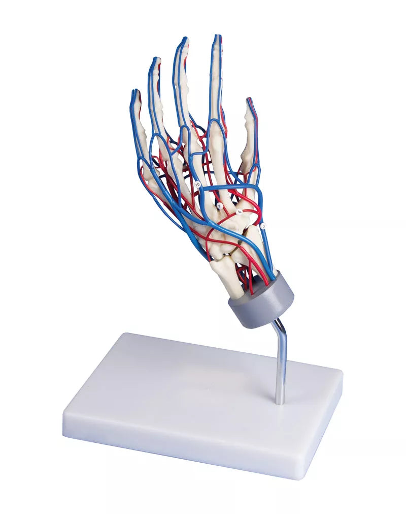 Erler-Zimmer Gefäßhand Modell