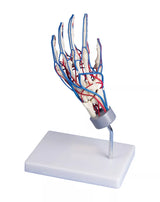 Erler-Zimmer Gefäßhand Modell