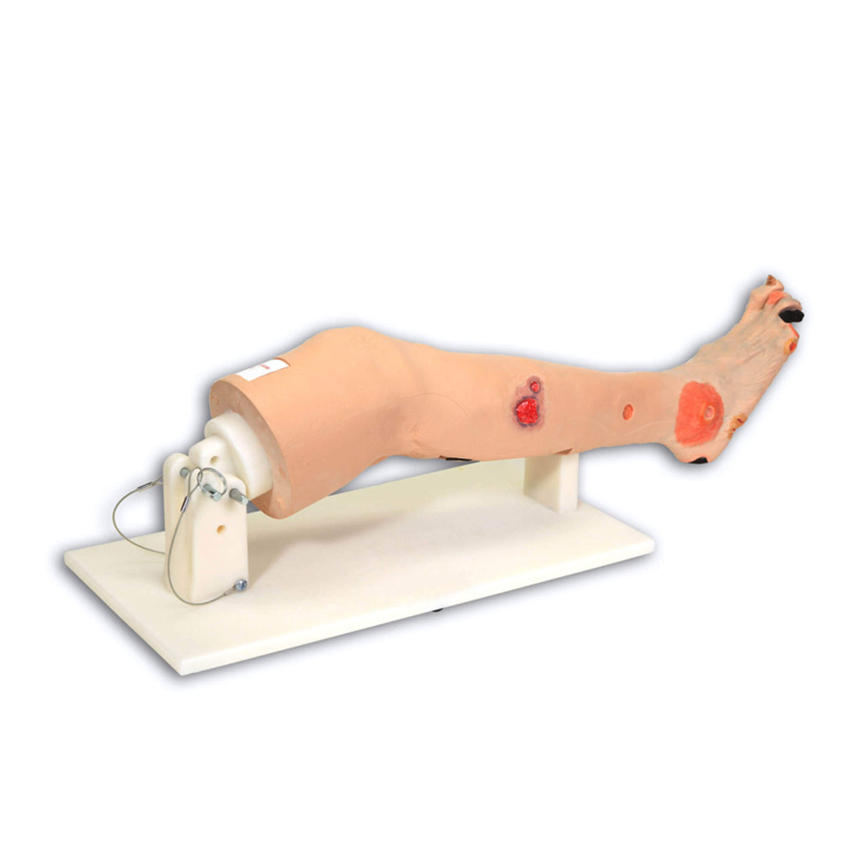 Erler-Zimmer Annie, Bein mit arterieller Insuffizienz