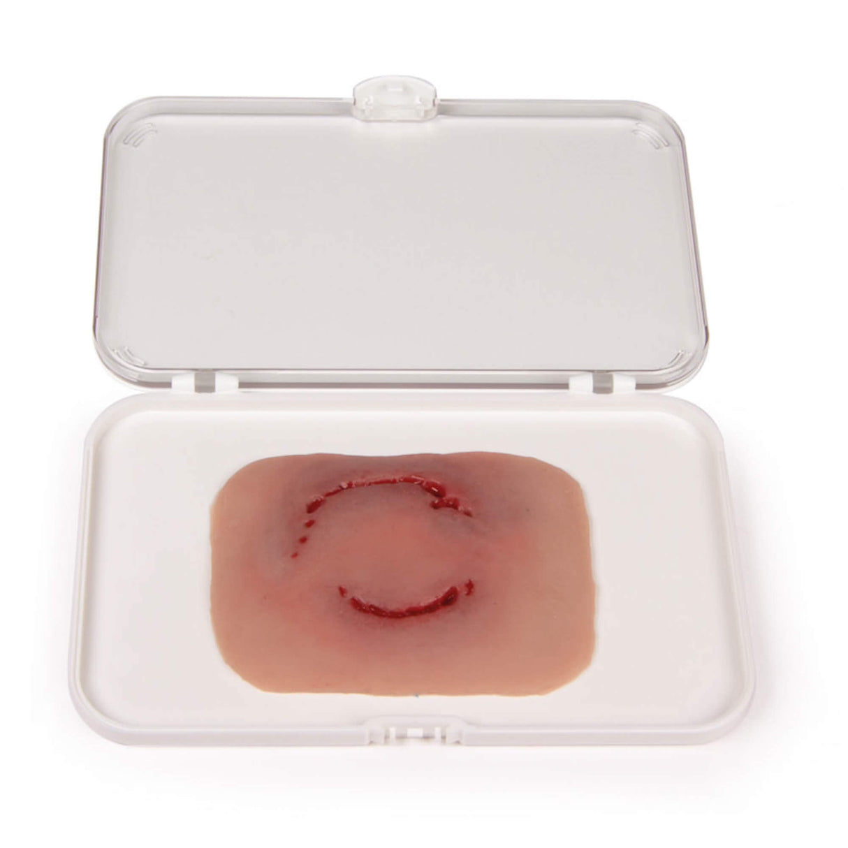 Erler-Zimmer Wundmoulage Bisswunde Mensch