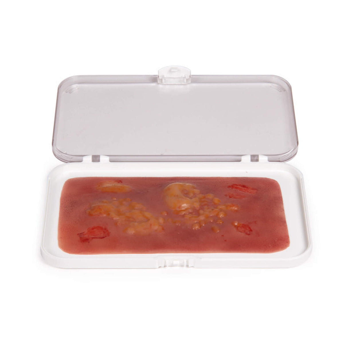 Erler-Zimmer Wundmoulage Brandwunde