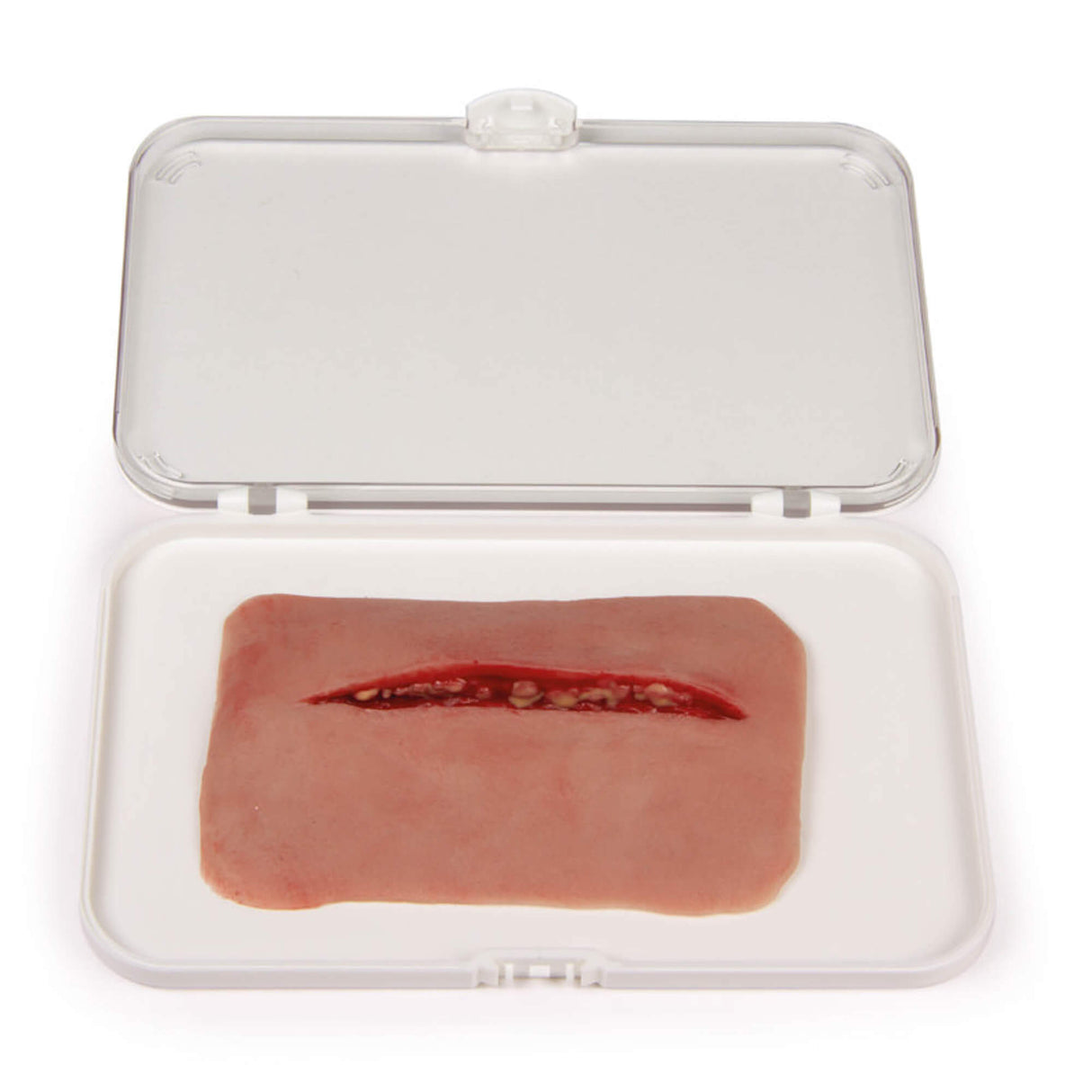 Erler-Zimmer Wundmoulage Schnittwunde
