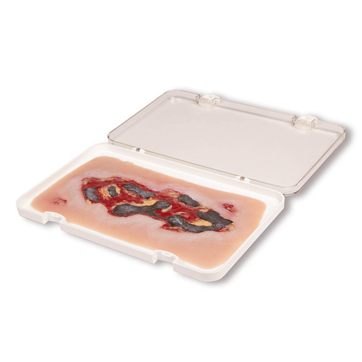 Erler-Zimmer Wundmoulage Ulcus Cruris Arteriosum