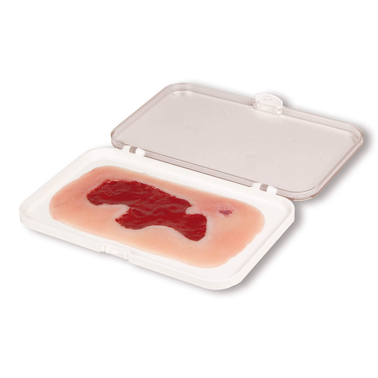 Erler-Zimmer Wundmoulage Ulcus Cruris Arteriosum