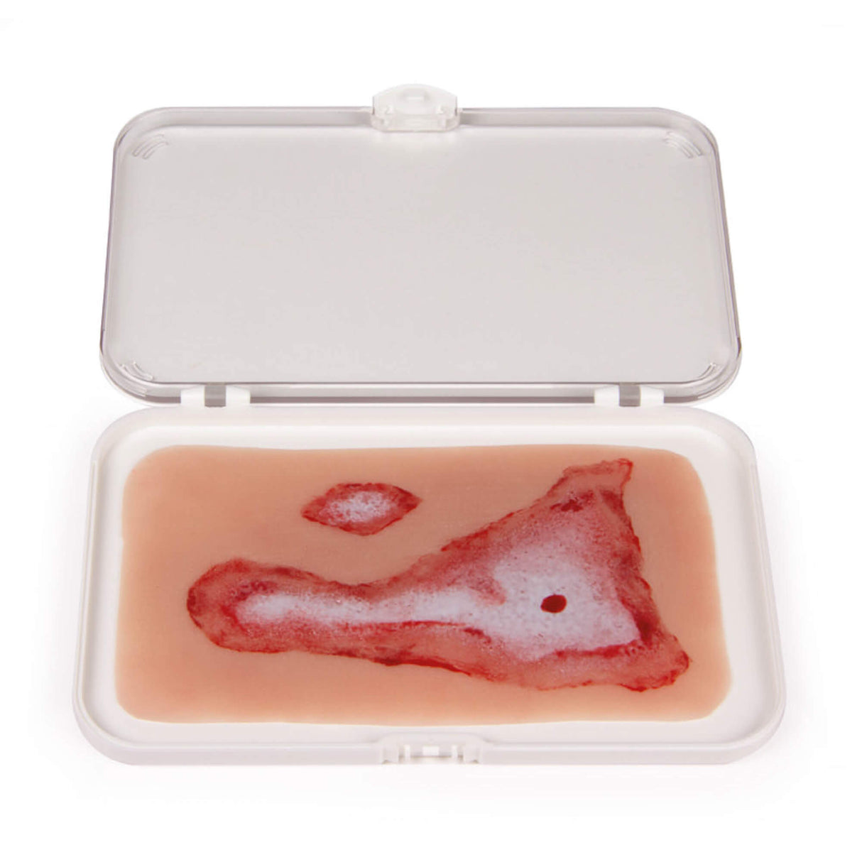 Erler-Zimmer Wundmoulage Verbrühung