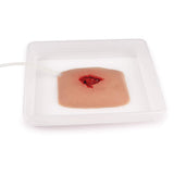 Erler-Zimmer Wundmoulage wound packing