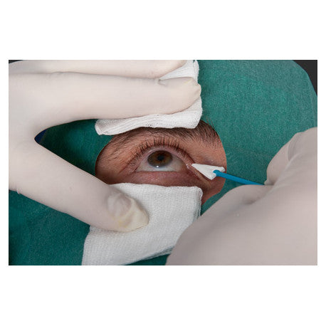 NOBA Nobaophthalm® Augentupfer 10 Stück 25 Stück