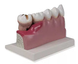 Erler-Zimmer Dentalmodell 4 fache Größe