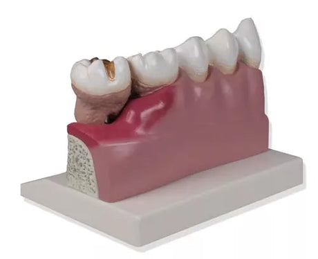 Erler-Zimmer Dentalmodell 4 fache Größe