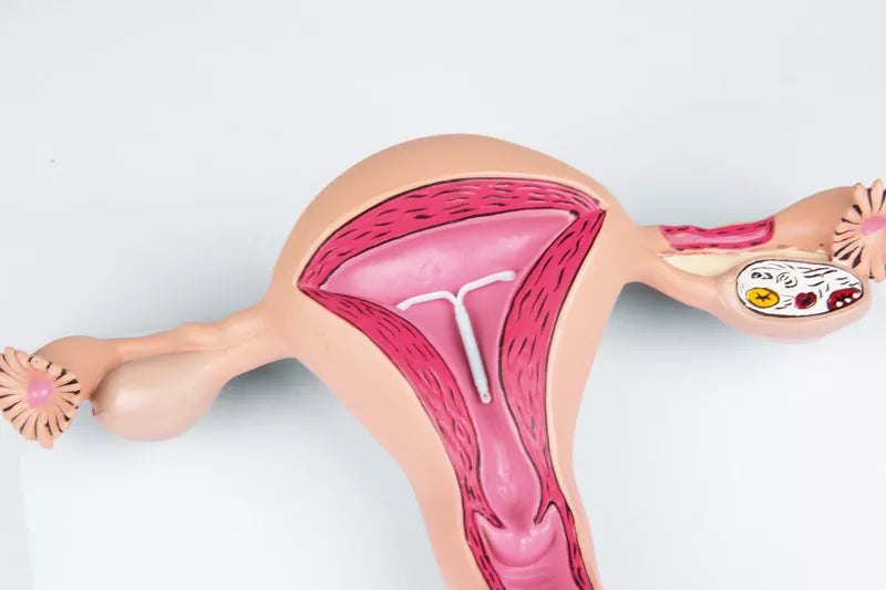 Erler-Zimmer Uterusmodell