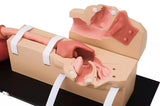 Erler-Zimmer OGD Oesophago Gastro Duodenoskopie Simulator