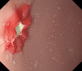 Erler-Zimmer OGD Oesophago Gastro Duodenoskopie Simulator