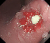 Erler-Zimmer OGD Oesophago Gastro Duodenoskopie Simulator
