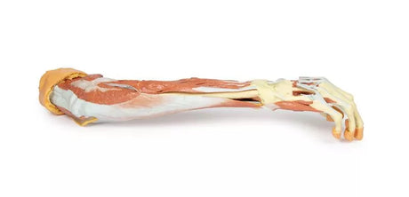 Erler-Zimmer Tiefe Präparation der oberen Extremität und Hand
