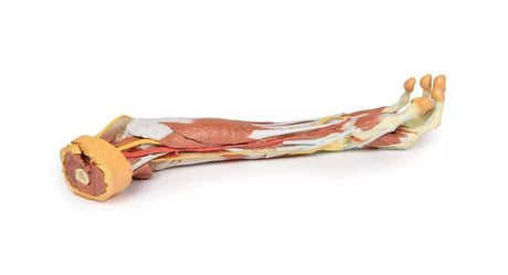 Erler-Zimmer Tiefe Präparation der oberen Extremität und Hand