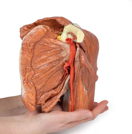 Erler-Zimmer Schulter (links) – Oberflächliche Muskeln mit Arteria axillaris/brachialis