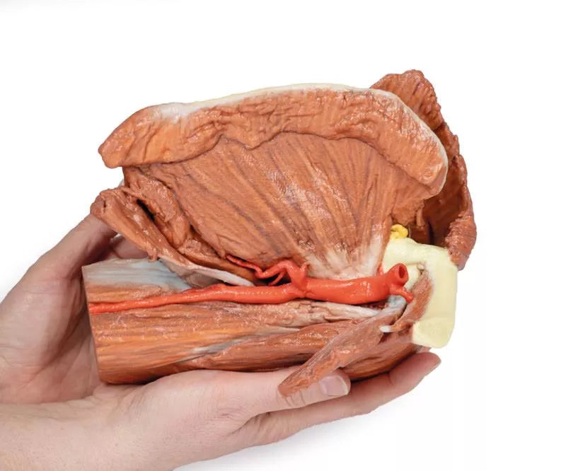 Erler-Zimmer Schulter (links) – Oberflächliche Muskeln mit Arteria axillaris/brachialis