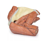 Erler-Zimmer Schulter (links) – Oberflächliche Muskeln mit Arteria axillaris/brachialis