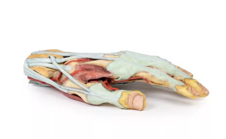 Erler-Zimmer Hand
