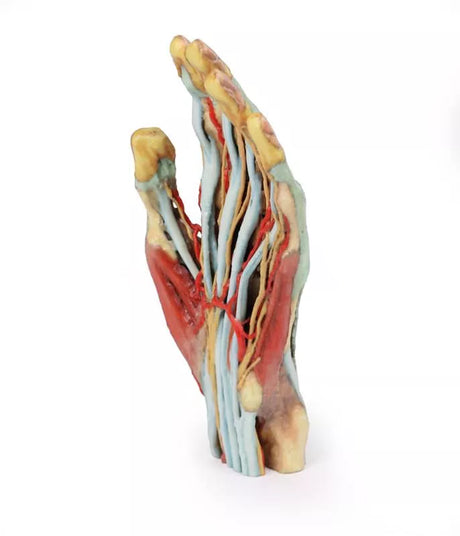 Erler-Zimmer Hand