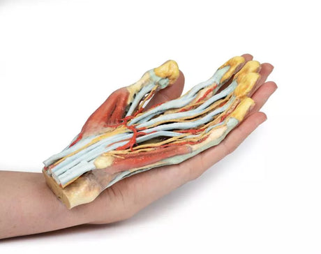 Erler-Zimmer Hand