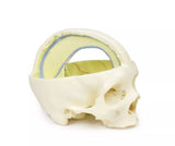Erler-Zimmer Schädelmodell mit Ansatz der Dura mater