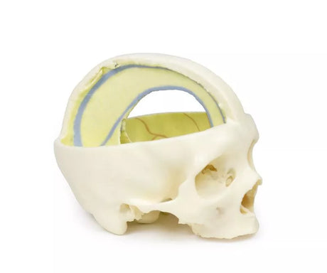 Erler-Zimmer Schädelmodell mit Ansatz der Dura mater