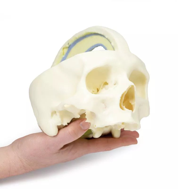 Erler-Zimmer Schädelmodell mit Ansatz der Dura mater