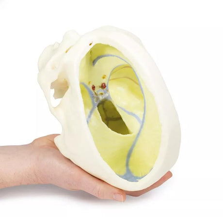 Erler-Zimmer Schädelmodell mit Ansatz der Dura mater