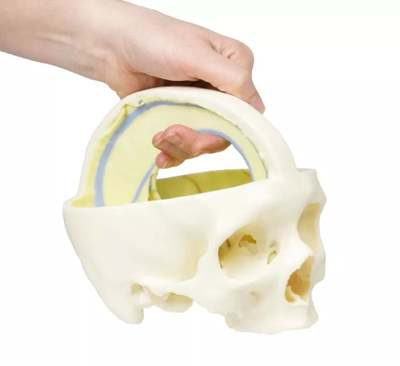 Erler-Zimmer Schädelmodell mit Ansatz der Dura mater