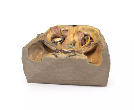 Erler-Zimmer Obere Orbita